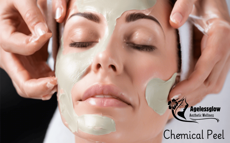 Peel Service 004 800x500 1