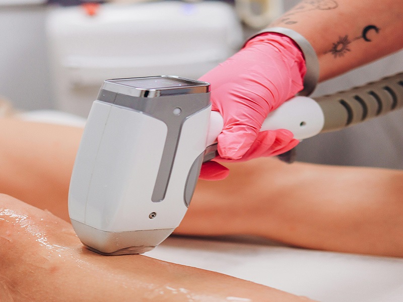 Laser Hair Removal 002 1